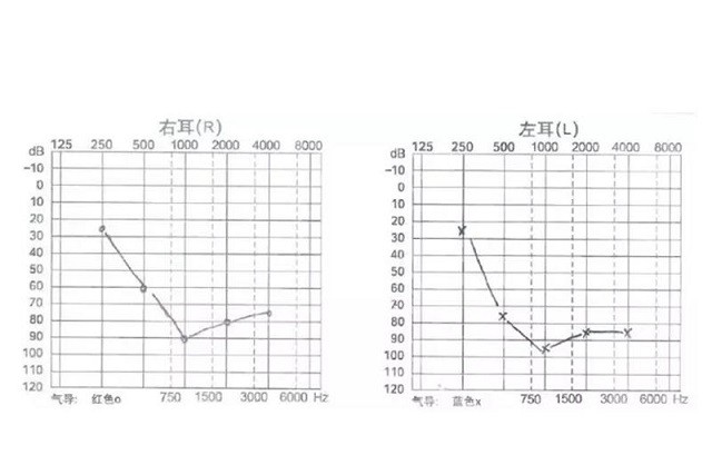 他的智能小聆聽(tīng)，生活充滿無(wú)限可能